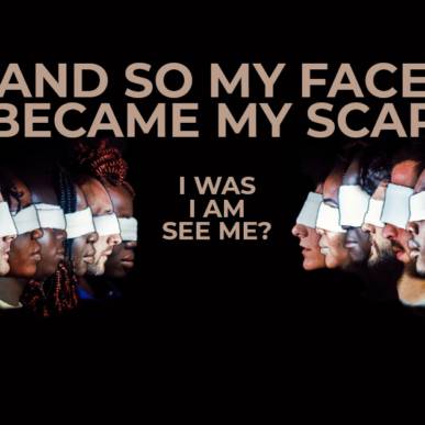 AND SO MY FACE BECAME MY SCAR – I WAS